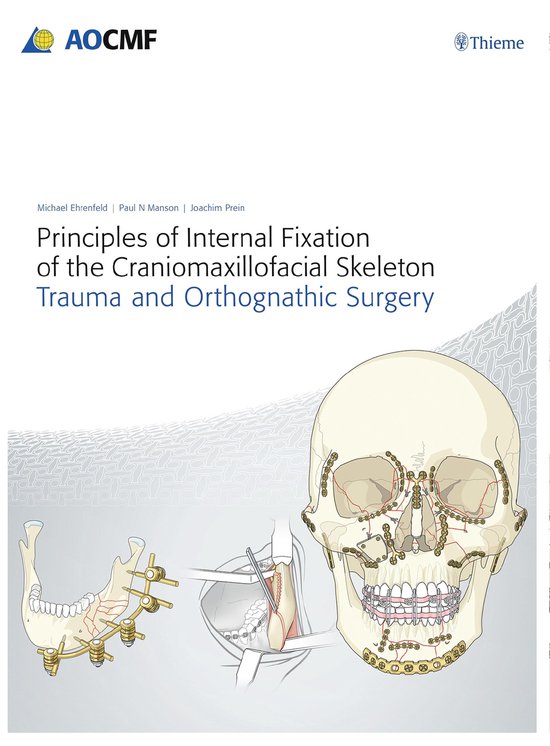 Principles of Internal Fixation of the Craniomaxillofacial S ... - cover
