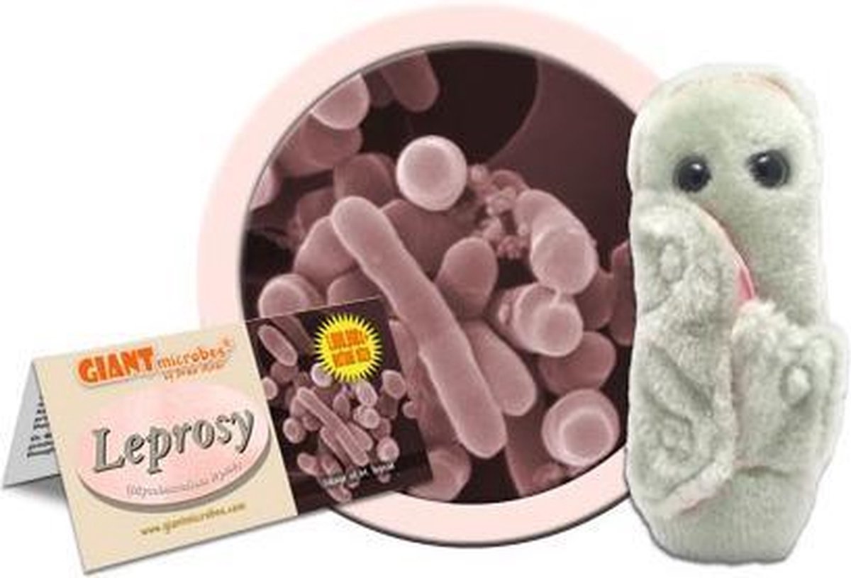 Leprosy (Mycobacterium Leprae)