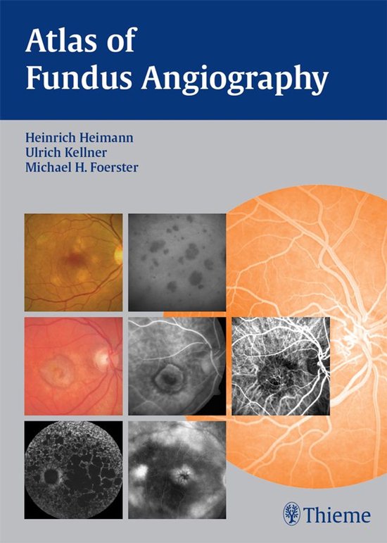 Atlas of Fundus Angiography - cover