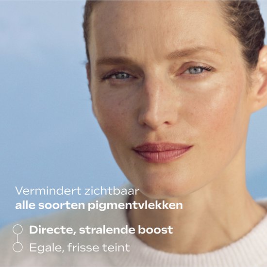 Close-up van een vrouwengezicht met lichte sproeten en een egale teint. Tekst over vermindering pigmentvlekken.