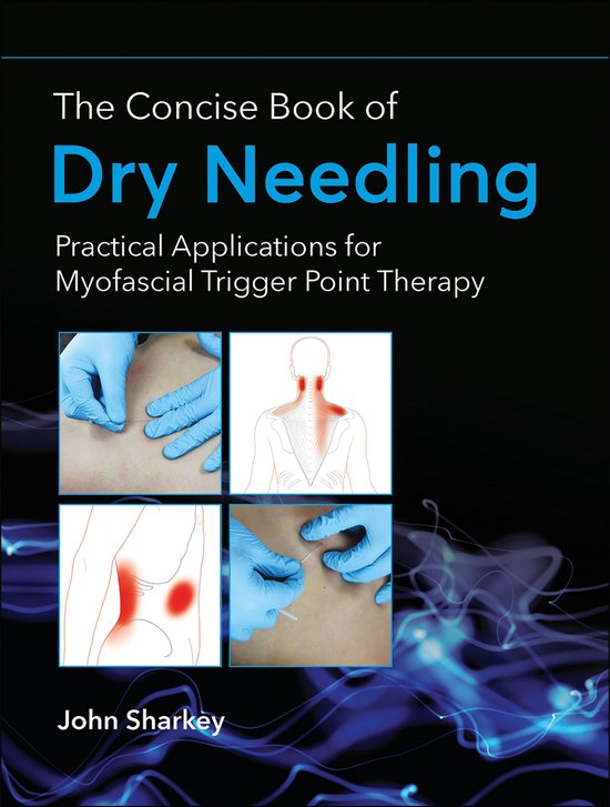 The Concise Book of Dry Needling - cover