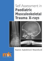 1 -  Self-assessment in Paediatric Musculoskeletal Trauma X-rays