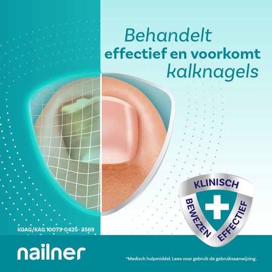 Nailner pen voor het behandelen en voorkomen van kalknagels. Klinisch bewezen effectief.