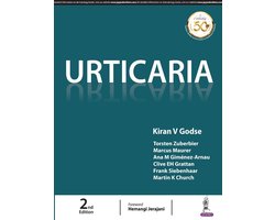 Urticaria