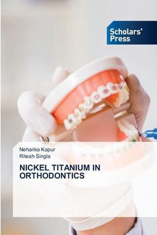 Nickel Titanium in Orthodontics, Neharika Kapur 9786138959090