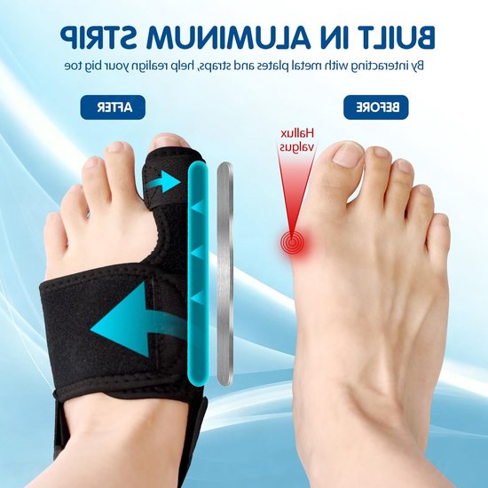 Hallux Valgus Corrector met Antislip Hielband voor Grote Teen - Bunion Ondersteuning en Hammer Teen - Zwart Rechts — afbeelding 2