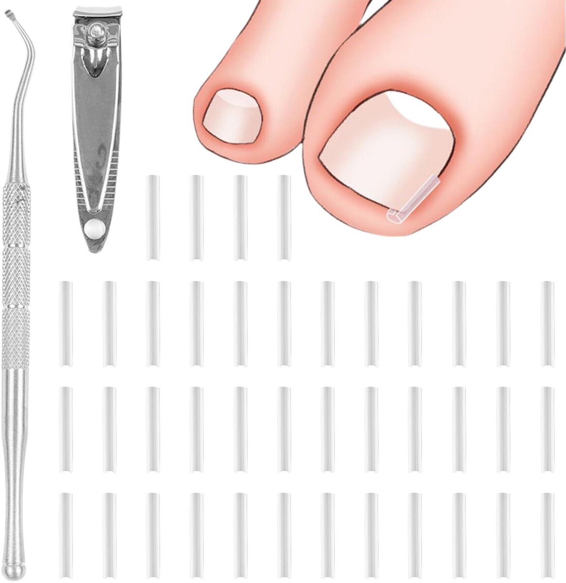 Dailygoods- Nagelcorrector 40 Stuks - Corrector voor Ingrowende Teennagels - Pedicure Gereedschap - Nagelschep - Nagelknipper - Verbeterde Nagelgezondheid - Teennagelcorrector