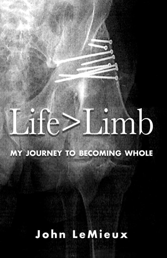 Life is Greater Than Limb - cover