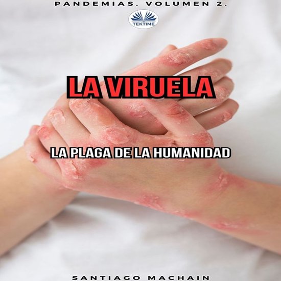 La Viruela - cover