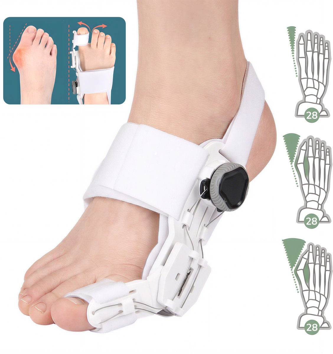 Hallux Valgus Grote Teencorrector - Hallux valgus teenspalk - Verstelbare beugel voor grote teen - 1 stuk - Eén maat - Voor linker- of rechtervoet - Met draaiknop en siliconen pad - Wit - Bunion Corrector - Teenspreiders voor Hallux Valgus -Teenspalk
