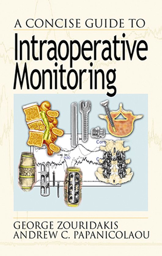 A Concise Guide to Intraoperative Monitoring - cover