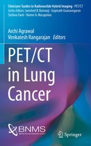 Clinicians’ Guides to Radionuclide Hybrid Imaging - PET/CT in Lung Cancer