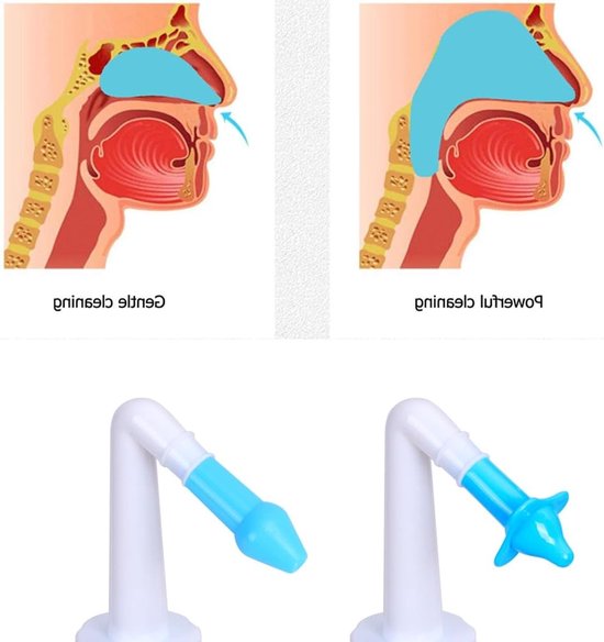 Nasal Reinigingsset voor Volwassenen en Kinderen, Neusspoeling en Sinusirrigatie, 300 ml, BPA-vrij en Effectieve Neusverzorging — afbeelding 3