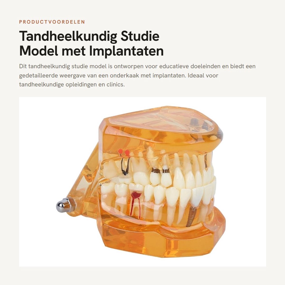 Dailygoods - Tandheelkundig Studie Model met Implantaten voor Educatie