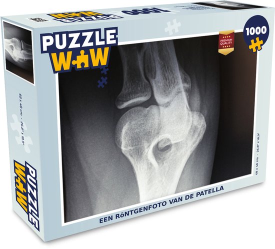 Puzzel Een röntgenfoto van de patella - Legpuzzel - Puzzel 1000 stukjes  volwassenen | bol.com