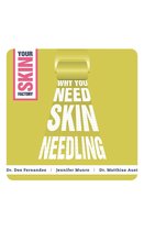 Why You Need Skin Needling