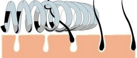 Close-up illustratie van een spiraalvormig epileerapparaat dat haren verwijdert bij de wortel.