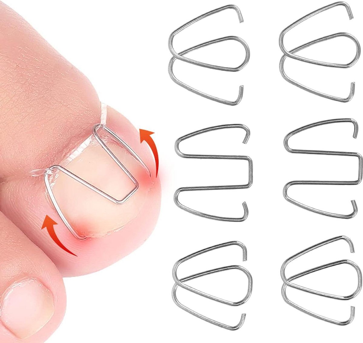 Ingrown Toenail Corrector Hook - Nail Correction Strips Thread Lifter Tool for Recovery - Women Men Corrector .