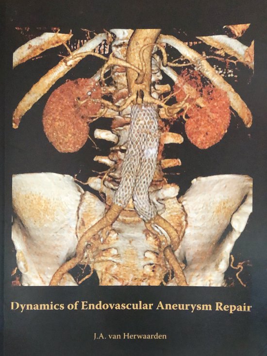 Dynamics of Endovascular Aneurysm Repair - cover