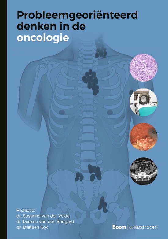 Probleemgeoriënteerd denken in de oncologie - cover