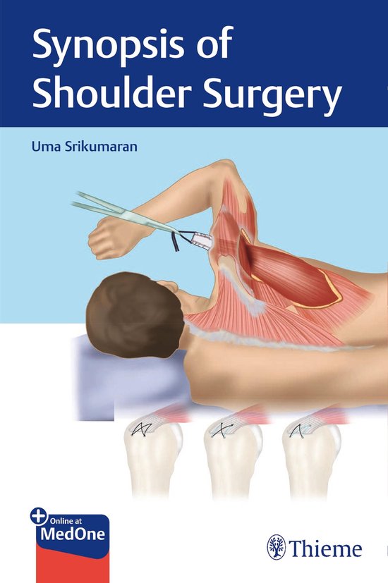 Synopsis of Shoulder Surgery - cover