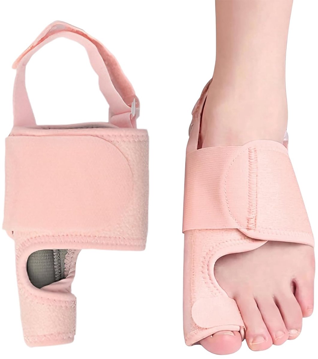 Hallux Valgus corrector linkervoet, verstelbare correctieborthese met roze aluminium plaat, teenrechter en teenspreider ter verlichting van de eeltknobbel, nacht en dag, 1 stuk