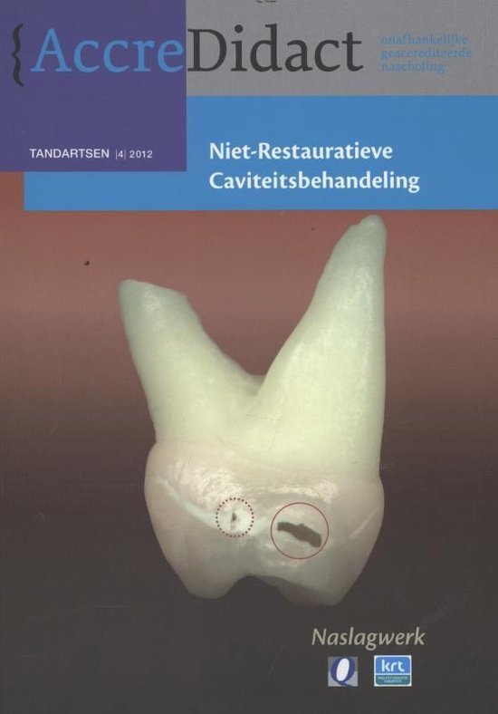 Cover van het boek 'Niet-restauratieve caviteitsbehandeling'
