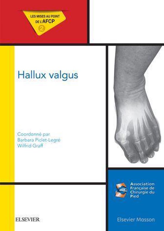 Hallux valgus - cover
