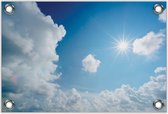 Tuinposter –Blauwe Lucht met Wolken en Zon– 60x40 Foto op Tuinposter (wanddecoratie voor buiten en binnen)
