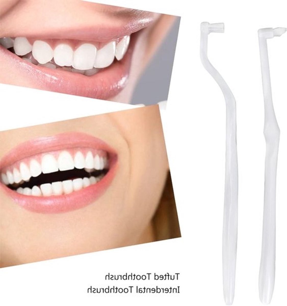 Tandenborstel - Zachte Opzetborstel - Interdentale Reiniging - Orthodontische Beugel - Ergonomisch Handvat - Mondgezondheid - Interdentale Borstel