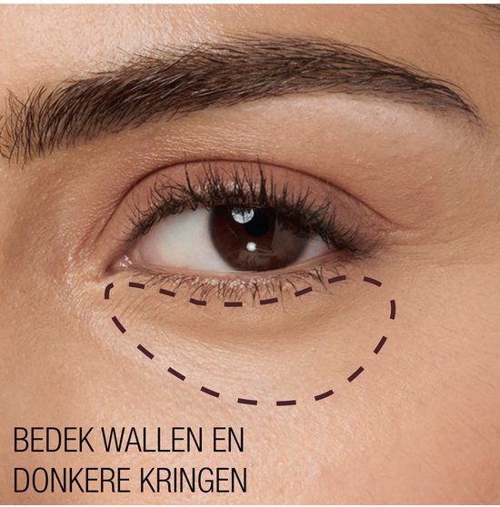Onder het oog van een vrouw, met de nadruk op wallen en donkere kringen, aangegeven met stippellijnen.