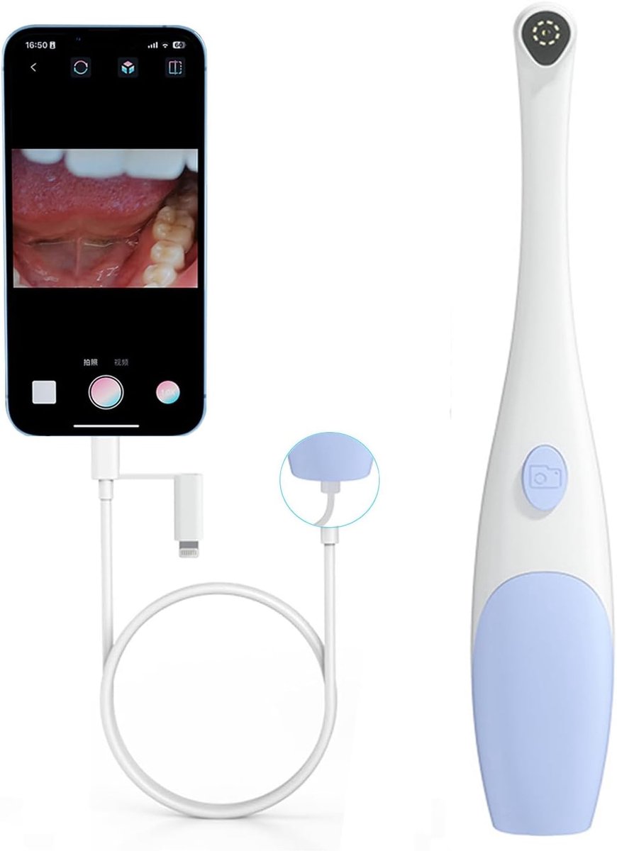 SnelShoppen - 1920P HD Oral Endoscope Intraorale Camera met 8 LED Lichten voor iPhone en Android, Ideaal voor Dieren en Mensen, Plug and Play