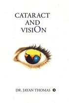 Cataract and Vision