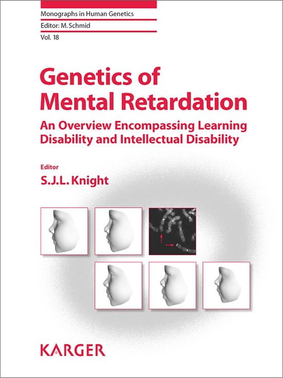 Genetics of Mental Retardation - cover