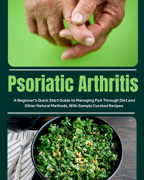 Psoriatic Arthritis (ebook), Tyler Spellmann 6610000400133 Boeken bol