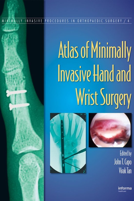 Minimally Invasive Procedures in Orthopaedic Surgery - Atlas ... - cover