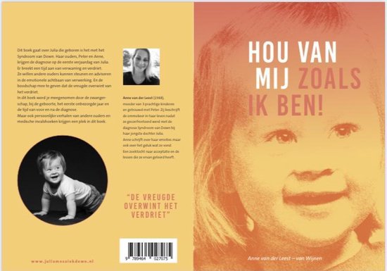 Hou van mij zoals ik ben! Syndroom van down