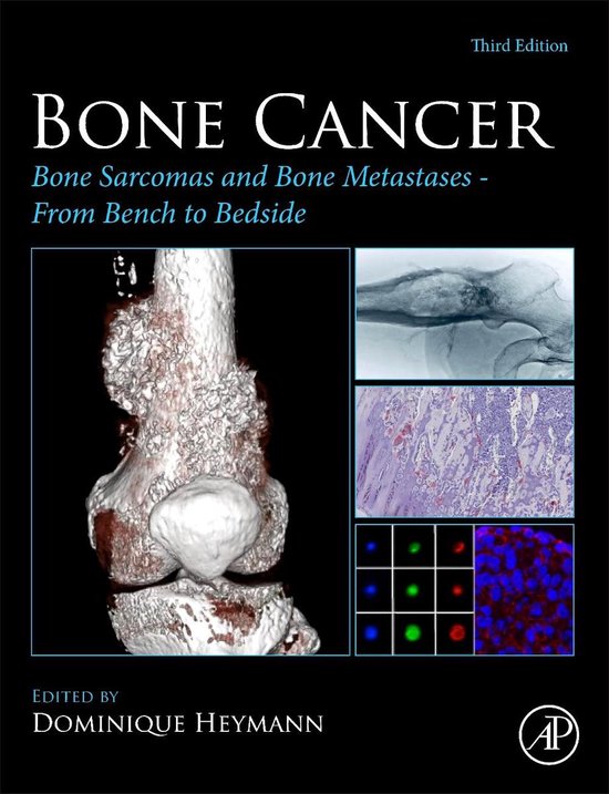 Bone Cancer - cover