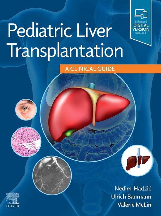 Pediatric Liver Transplantation - cover