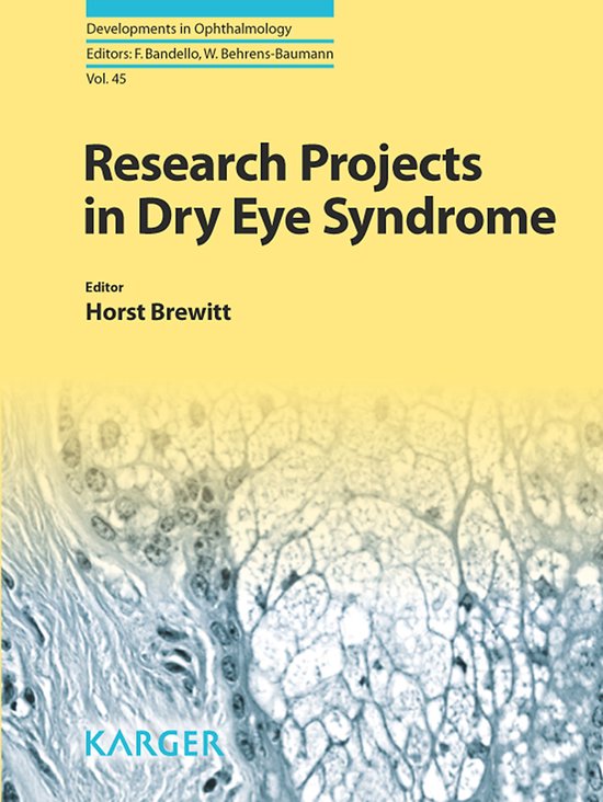 Research Projects in Dry Eye Syndrome - cover