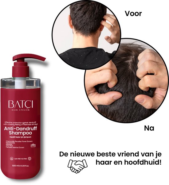 BATCI Anti Roos Shampoo - Voedende Formule Verrijkt met Niacinamide & Aloë Vera voor Hoofdhuidverzorging - 500 ml