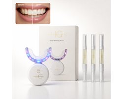 HG Aesthetics Tandenbleek Set LED – Teeth Whitening Kit voor Thuis – Professionele Tandenbleker – Tanden Bleken 10-15 min – Whitening Gel – USB Oplaadbaar