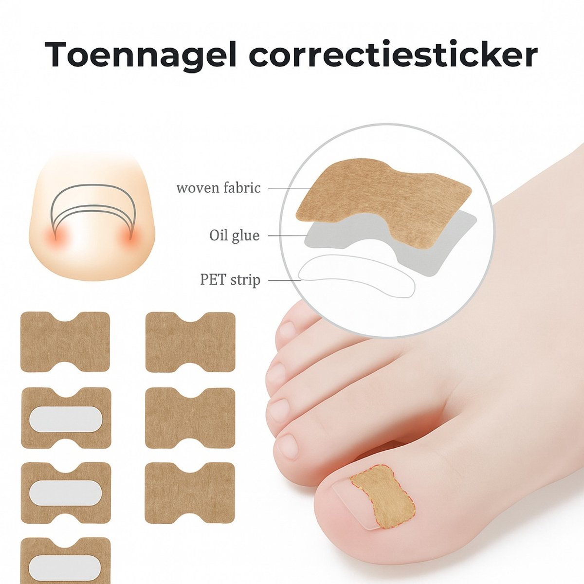 Goedkoopste Teennagel Lifter Pleisters 30 Stuk I Ingegroeide Teennagel Corrector I Teennagel I Anti Ingroei Pleister I Nagel Correctie Kit