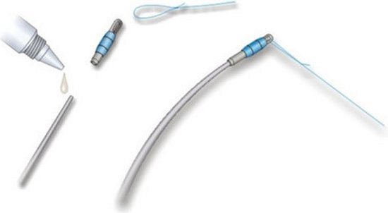 Stonfo Tip Connector (2 pcs) - Maat : 1.5mm van Merkloos — afbeelding 2