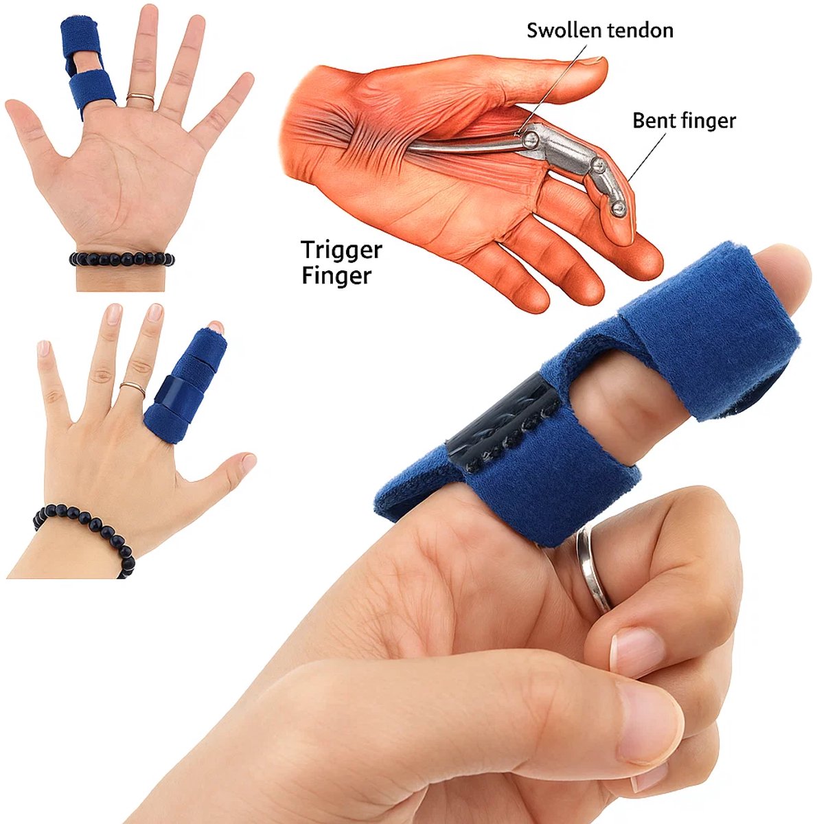 Goedkoopste Vingerspalk I Vingerbrace I Vingerfixatieriem I Revalidatiespalk I Vinger Splint I Rechttrekken Vinger I Dual Strap I Zwart