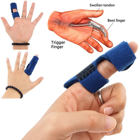 Vingerspalk I Vingerbrace I Vingerfixatieriem I Revalidatiespalk I Vinger Splint I Rechttrekken Vinger I Dual Strap I Zwart