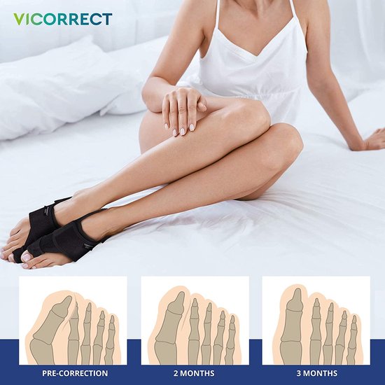 FGRID Bunion-voetcorrectorsandalen voor dames, orthopedische schoen met