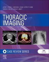 Case Review - Thoracic Imaging: Case Review Series
