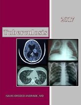 Tuberculosis 2017: English Edition