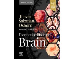 Diagnostic Imaging: Brain | 9780323756204 | Miral D. Jhaveri